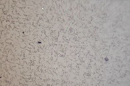 اكتشاف المرحلة الذهبية-500 مرة المرحلة الذهبية